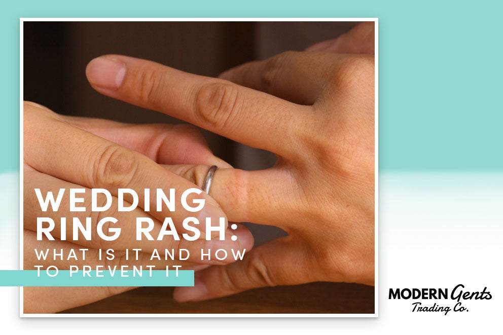 Wedding Ring Rash: What Is It and How to Prevent It