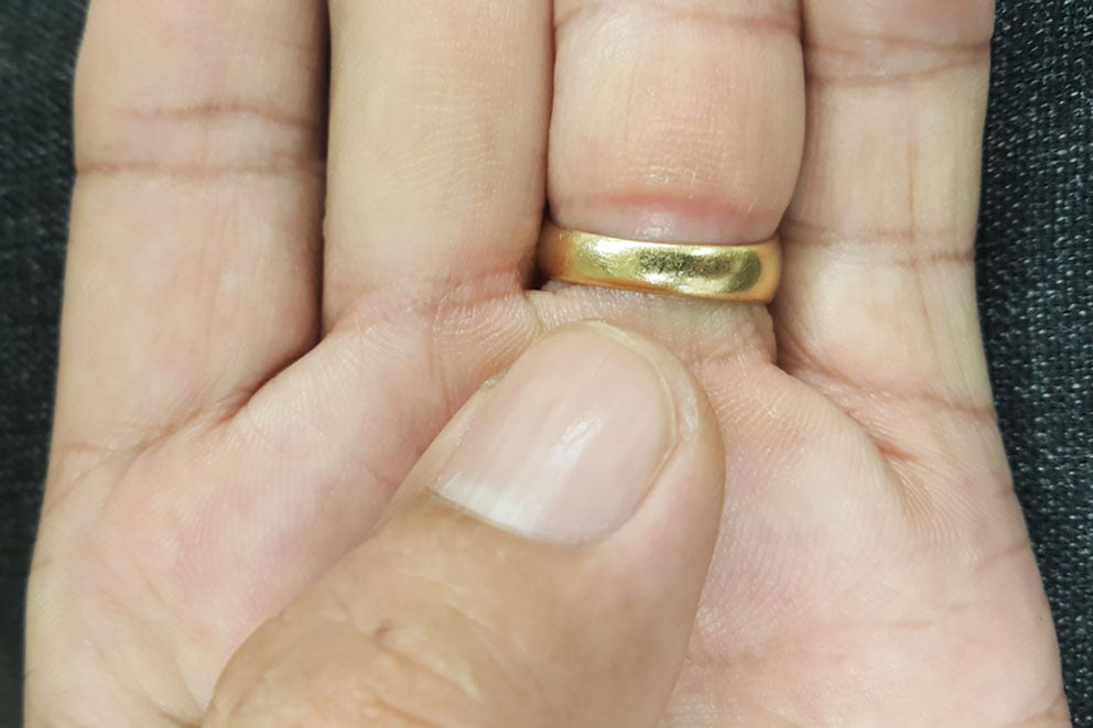 a close up of someones hand wearing a tight wedding band